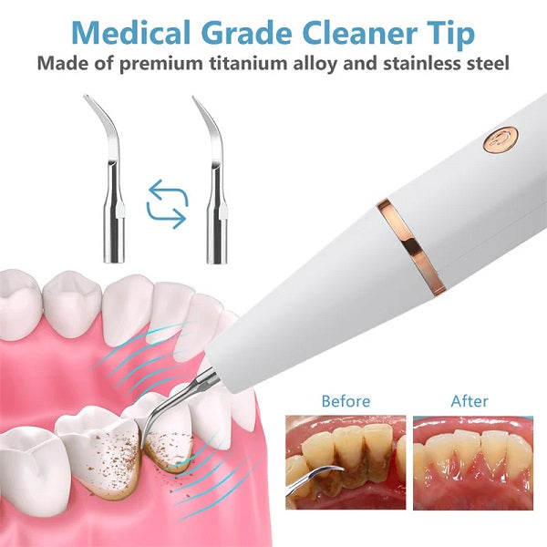 Rechargeable Electric Teeth Cleaner