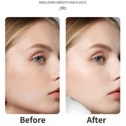 Ice Compressor for Face