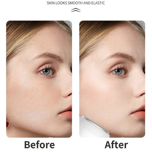 Ice Compressor for Face